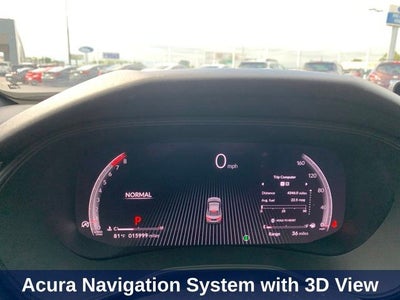 2025 Acura TLX A-Spec Package SH-AWD
